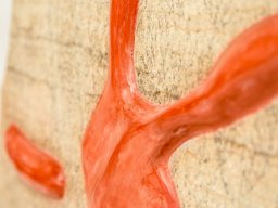 Bildcollage Million Years