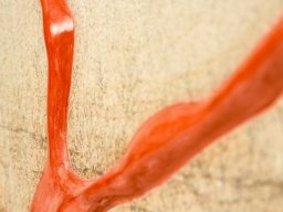 Bildcollage Million Years